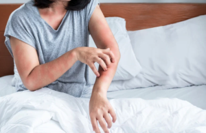 アレルギーによるかゆみ